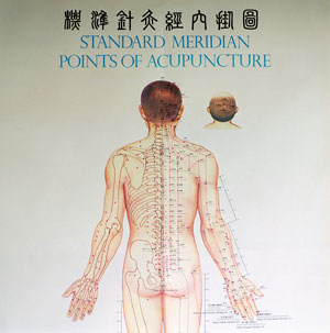 Acupuncture Services in Tucson